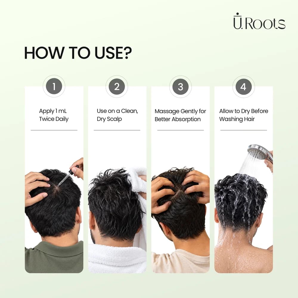 URoots Minbur 10F+ | Maximum Strength Hair Tonic | 10% Minoxidil + 0.1% Finasteride | 60ml | For Men